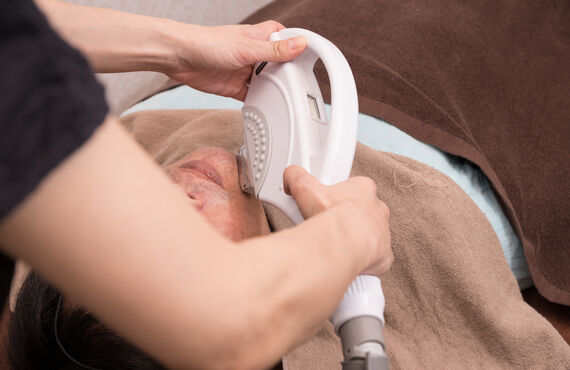 お顔周りのムダ毛を丁寧に脱毛してまいります | 堺筋本町でメンズ脱毛ならラヴィアンローズオム本町店